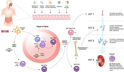 The role of BAFF and APRIL in IgA nephropathy: pathogenic mechanisms and targeted therapies
